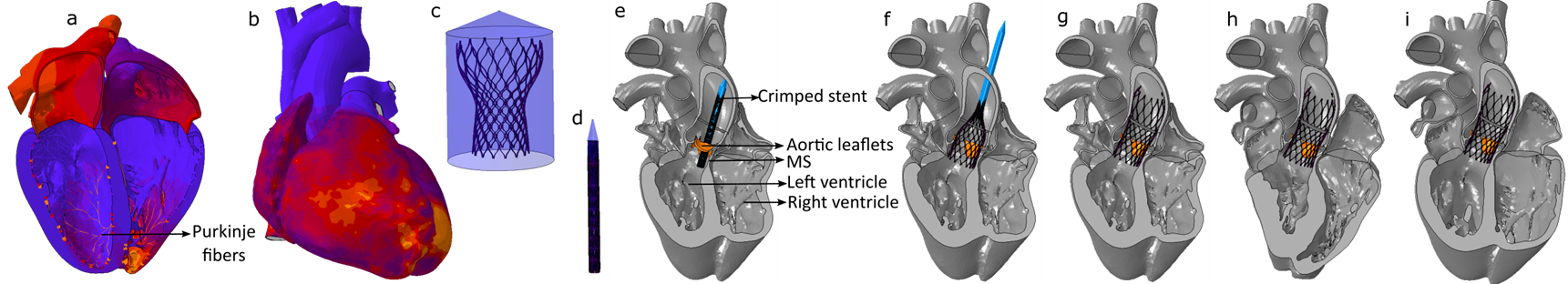 TAVR in LHP