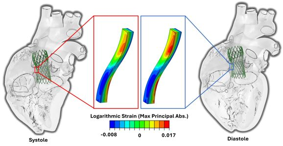 Strut_Strain